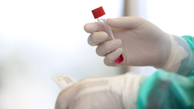 Valdība apstiprina valsts pētījumu programmu “Covid-19 seku mazināšanai”