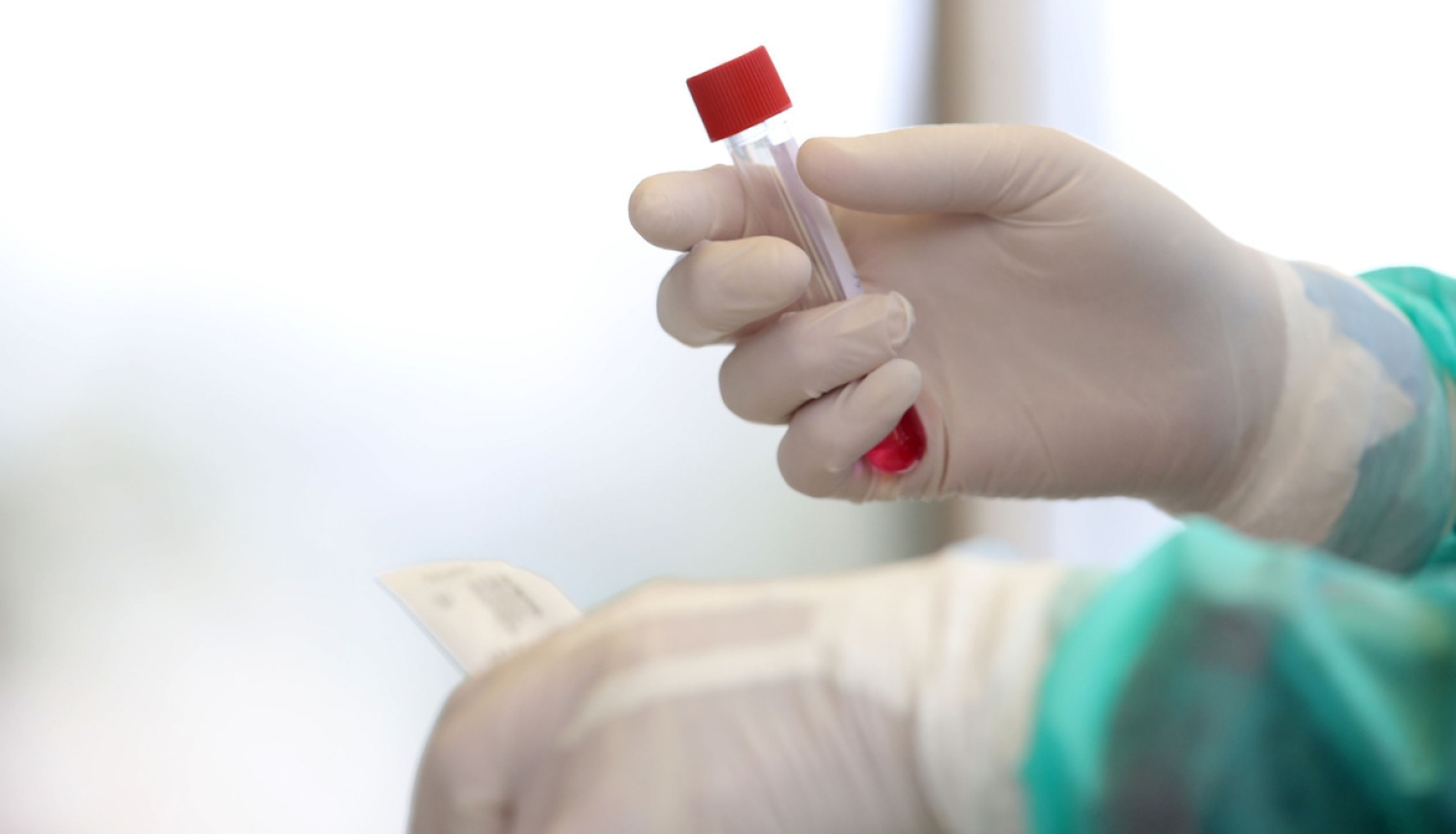 Valdība apstiprina valsts pētījumu programmu “Covid-19 seku mazināšanai”